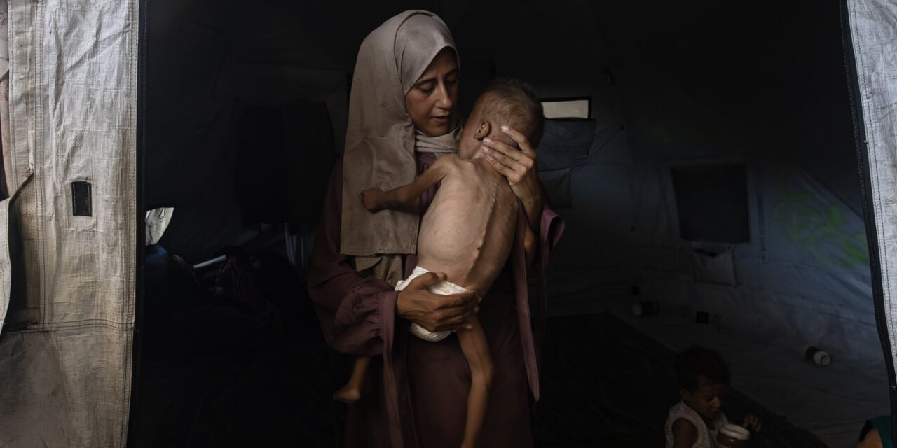 Gazans Are Dying of Starvation